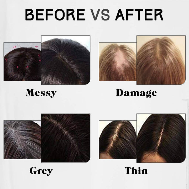 Toppers Hair Pieces 12*6cm Remy Human Hair Balayage Brown #4/27/4 |Easyouth