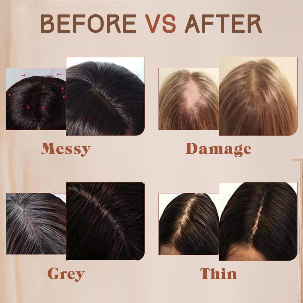 female hair topper for thinning crown real hair toppers hair toppers for thinning hair